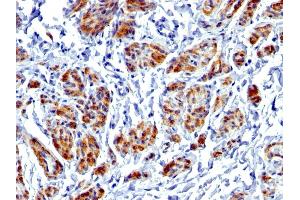 Formalin-fixed, paraffin-embedded human Uterus stained with Caldesmon Rabbit Recombinant Monoclonal Antibody (CALD1/1424R). (Recombinant Caldesmon antibody)