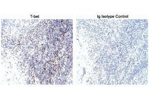 Immunohistochemistry (IHC) image for anti-T-Bet antibody (ABIN967673) (T-Bet antibody)