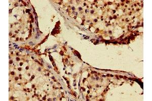 Immunohistochemistry of paraffin-embedded human testis tissue using ABIN7147226 at dilution of 1:100 (MNAT1 antibody  (AA 1-309))