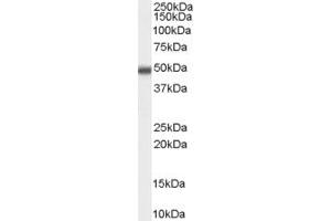 ABIN334432 (0. (MBD2 antibody  (Internal Region))