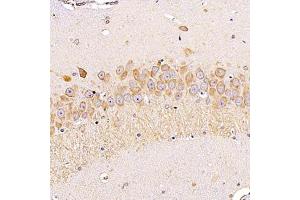 Immunohistochemistry analysis of paraffin-embedded rathippocampususing ALG6 (ABIN7073127) at dilution of 1:1200 (ALG6 antibody)