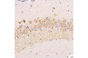 Immunohistochemistry analysis of paraffin-embedded rathippocampususing ALG6 (ABIN7073127) at dilution of 1:1200 (ALG6 antibody)