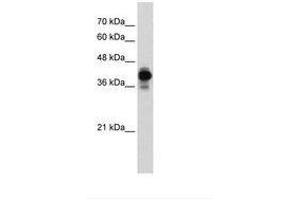 Image no. 1 for anti-Heterogeneous Nuclear Ribonucleoprotein C (C1/C2) (HNRNPC) (AA 80-129) antibody (ABIN6736287) (HNRNPC antibody  (AA 80-129))