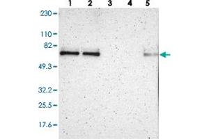 Western blot analysis of Lane 1: RT-4, Lane 2: U-251 MG, Lane 3: Human Plasma, Lane 4: Liver, Lane 5: Tonsil with ZNF384 polyclonal antibody  at 1:250-1:500 dilution.