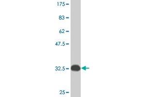 Western Blot detection against Immunogen (33. (ATOX1 antibody  (AA 1-68))