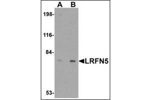 Western blot analysis of LRFN5 in EL4 cell lysate with this product at (A) 0. (LRFN5 antibody  (C-Term))