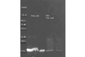 Western Blotting (WB) image for anti-Trypsin Inhibitor antibody (ABIN107871) (Trypsin Inhibitor antibody)