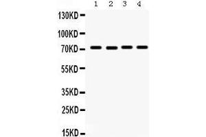 Western Blotting (WB) image for anti-Fragile X Mental Retardation 1 (FMR1) (AA 164-200), (N-Term) antibody (ABIN3042398) (FMR1 antibody  (N-Term))