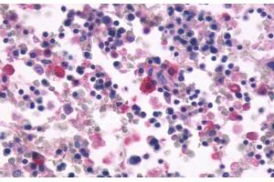Anti-CD97 antibody  ABIN1048416 IHC staining of human bone marrow.