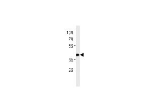 Western blot analysis in SW620 cell line lysates (35ug/lane). (SLC2A4RG antibody  (AA 213-242))