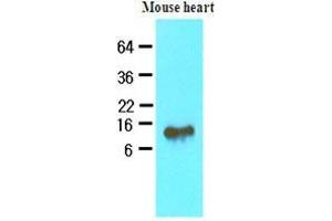 The extracts of mouse heart (40 ug) were resolved by SDS-PAGE, transferred to nitrocellulose membrane and probed with anti-human FABP4 (1:500). (FABP4 antibody  (AA 1-132))