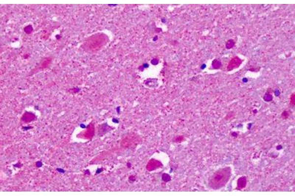 CELSR2 antibody  (C-Term)