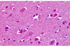 Anti-CELSR2 antibody IHC staining of human brain, cortex, neurons. (CELSR2 antibody  (C-Term))