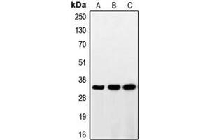 Western blot analysis of RNF144A expression in HeLa (A), HepG2 (B), Jurkat (C) whole cell lysates.