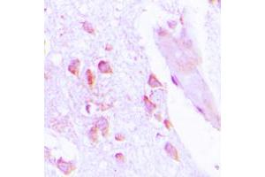 Immunohistochemical analysis of ABHD12B staining in human brain formalin fixed paraffin embedded tissue section. (ABHD12B antibody  (C-Term))