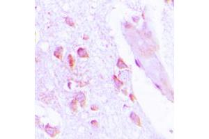 Immunohistochemical analysis of ABHD12B staining in human brain formalin fixed paraffin embedded tissue section. (ABHD12B antibody  (C-Term))