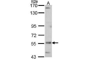 WB Image Sample (30 ug of whole cell lysate) A: A431 , 7. (ADCK4 antibody  (Center))