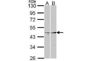 WB Image Sample (30 ug of whole cell lysate) A: A431 , B: Hela 10% SDS PAGE Fibromodulin antibody antibody diluted at 1:1000 (Fibromodulin antibody)