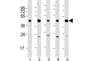 Western blot testing of human 1) 293T/17, 2) A431, 3) HeLa, 4) Jurkat and 5) K562 cell lysate with PHF6 antibody at 1:2000.
