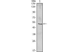 Western blot analysis using NFKBIB mouse mAb against Jurkat (1) cell lysate. (NFKBIB antibody)