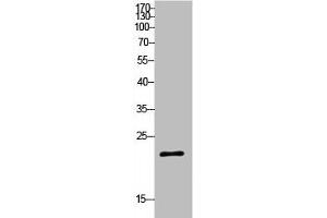 Western Blot analysis of HeLa cells using SRY Polyclonal Antibody (SRY antibody  (Internal Region))