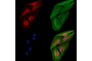 ABIN6258507 and ABIN6274710 staining  cells by IF/ICC. (EFTUD2 antibody  (N-Term))