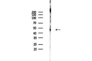 anti-CaMKIIalpha/delta (pThr286) antibody