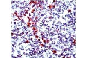 Formalin fixed paraffin embedded human tonsil stained with Granzyme B antibody. (GZMB antibody  (N-Term))