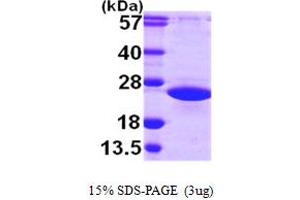 SDS-PAGE (SDS) image for ADP-Ribosylation Factor-Like 2 (ARL2) (AA 1-184) protein (His tag) (ABIN667306) (ARL2 Protein (AA 1-184) (His tag))