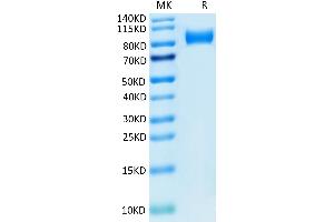 ITGB6 Protein (AA 22-706) (His tag)