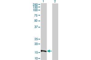 Western Blot analysis of EIF4EBP3 expression in transfected 293T cell line by EIF4EBP3 monoclonal antibody (M05), clone 4C1.