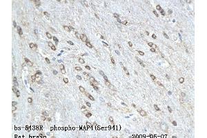 Formalin-fixed and paraffin embedded rat colitis labeled with Anti-phospho-MAP4(Ser941) Polyclonal Antibody, Unconjugated (ABIN802068) followed by conjugation to the secondary antibody and DAB staining