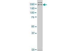 DENND4A polyclonal antibody (A01), Lot # 060613JCS1 Western Blot analysis of DENND4A expression in U-2 OS . (DENND4A antibody  (AA 1-101))