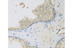 Immunohistochemistry of paraffin-embedded Human prostate using LLGL2 Polyclonal Antibody at dilution of 1:200 (40x lens). (LLGL2 antibody)