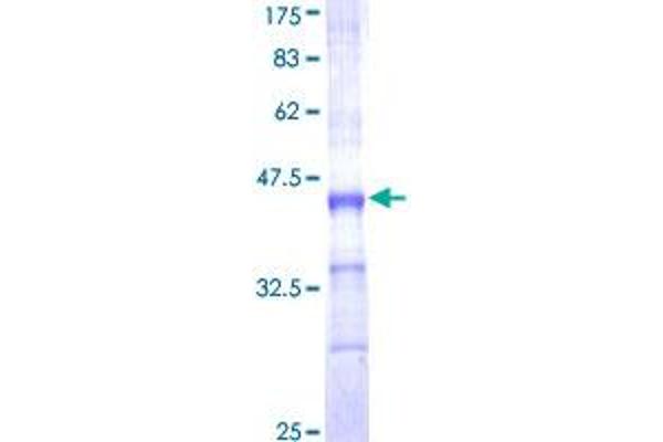 CYP1A2 Protein (AA 211-310) (GST tag)