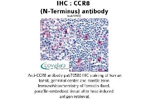 Image no. 1 for anti-Chemokine (C-C Motif) Receptor 8 (CCR8) (Extracellular Domain), (N-Term) antibody (ABIN1732786) (CCR8 antibody  (Extracellular Domain, N-Term))