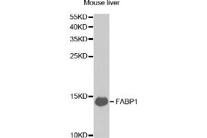 Western blot analysis of extracts of mouse liver, using FABP1 antibody (ABIN5973056) at 1/1000 dilution. (FABP1 antibody)