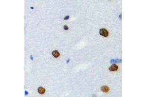 Immunohistochemical analysis of hnRNP LL staining in human brain formalin fixed paraffin embedded tissue section. (HNRPLL antibody  (Center))