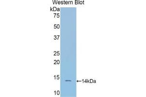 Western blot analysis of the recombinant protein. (SFRP4 antibody  (AA 167-260))