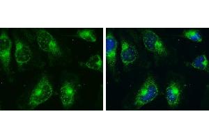 ICC/IF Image AMPK alpha 2 antibody detects AMPK alpha 2 protein at cytoplasm and nucleus by immunofluorescent analysis. (PRKAA2 antibody  (Center))