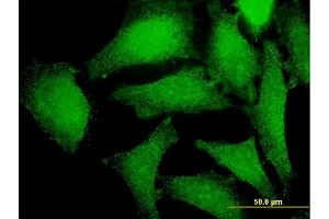 Immunofluorescence of monoclonal antibody to PRKAG2 on HeLa cell. (PRKAG2 antibody  (AA 191-300))