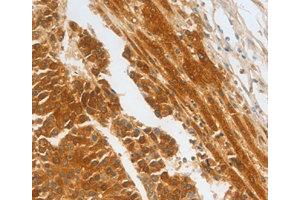 Immunohistochemistry (IHC) image for anti-Complement Factor H-Related 1 (CFHR1) antibody (ABIN1871806) (CFHR1 antibody)