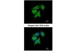 ICC/IF Image Immunofluorescence analysis of paraformaldehyde-fixed A549, using p40 , antibody at 1:200 dilution. (RABEPK antibody)