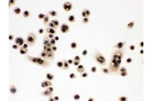 IHC testing of FFPE human SW480 cells with EIF3A antibody. (EIF6 antibody  (AA 66-210))