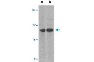 Western blot analysis of MARVELD1 in mouse heart tissue lysate with MARVELD1 polyclonal antibody  at (A) 1 and (B) 2 ug/mL . (MARVELD1 antibody  (N-Term))