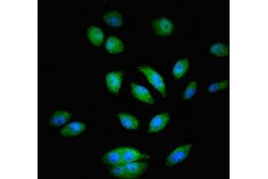 Immunofluorescent analysis of A549 cells using ABIN7166444 at dilution of 1:100 and Alexa Fluor 488-congugated AffiniPure Goat Anti-Rabbit IgG(H+L) (PTK2B antibody  (AA 707-875))