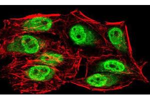 Immunofluorescence analysis of HeLa cells using SIRT6 mouse mAb (green). (SIRT6 antibody  (AA 141-250))