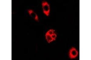Immunofluorescent analysis of GALE staining in A549 cells. (GALE antibody)