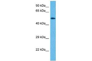 Host:  Mouse  Target Name:  VIM  Sample Tissue:  Mouse Small Intestine  Antibody Dilution:  1ug/ml (Vimentin antibody  (N-Term))