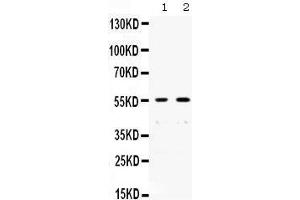 Western blot analysis of XRCC4 expression in SW620 whole cell lysates (lane 1) and A431 whole cell lysates (lane 1). (XRCC4 antibody  (N-Term))